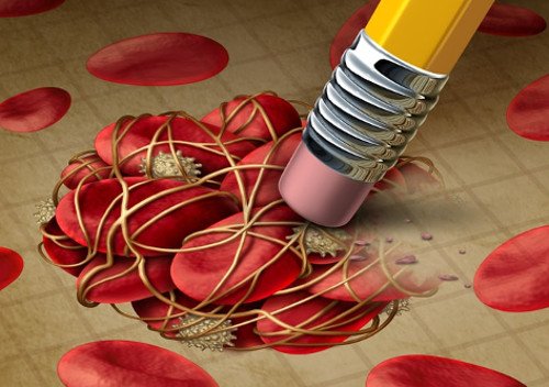 Blutverklumpung wird ausradiert mit Stift Blutverklumpung wird ausradiert mit Stift.