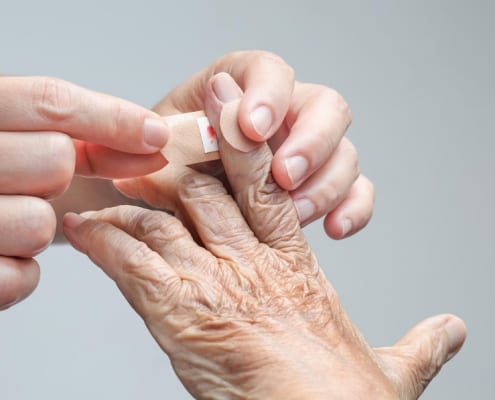 Orale Antikoagulation: Entwarnung bei leichten Blutungen