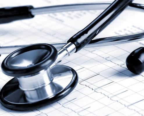 CV-Mortalität bei VHF: der Herzfrequenzvariabilitätsindex als Prädiktor